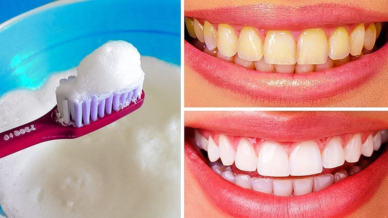 10 Maneiras Naturais de Clarear seus Dentes em Casa - YouTube