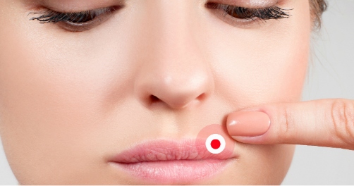7 ATITUDES para CURAR o HERPES