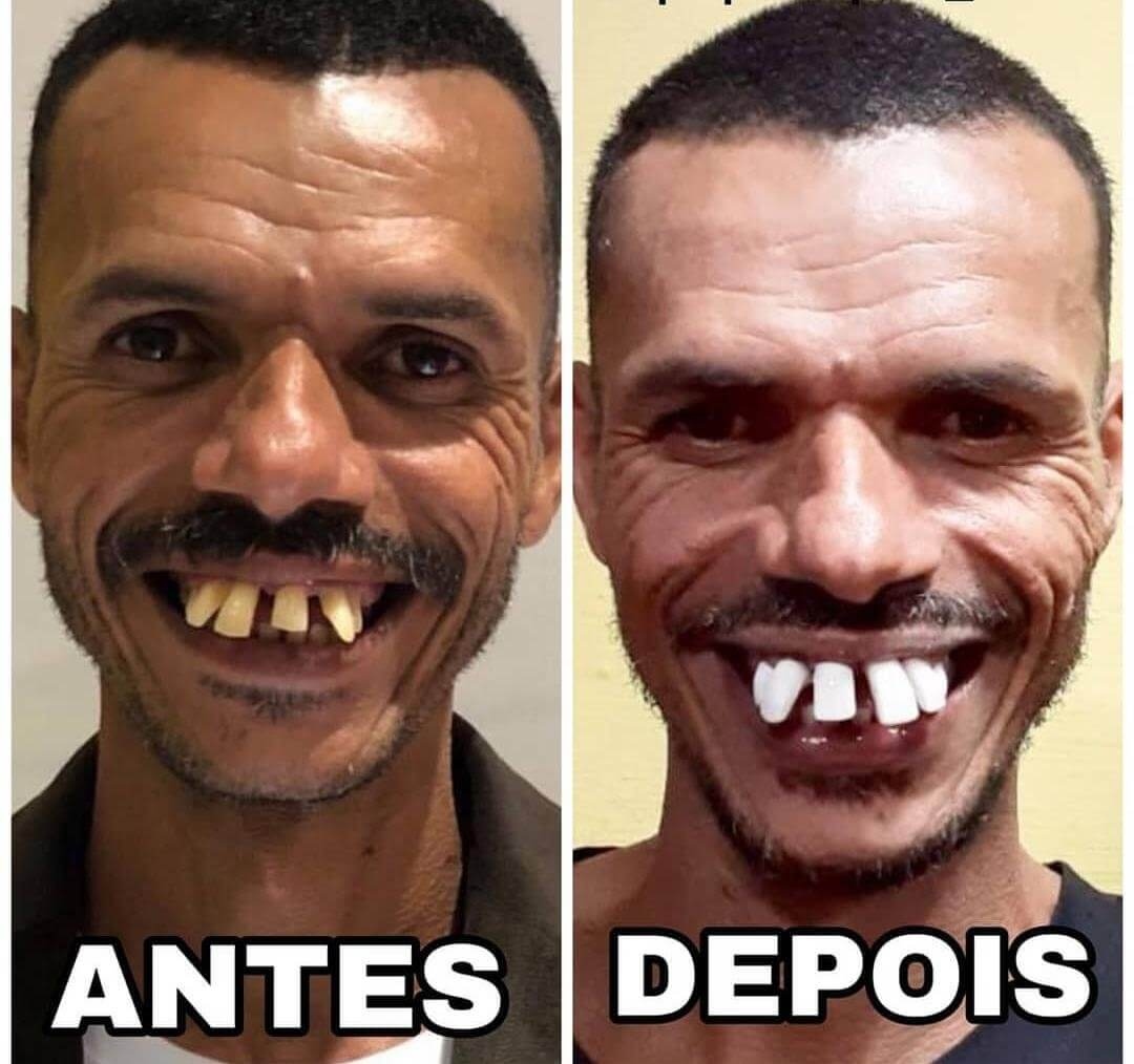 O Sorriso do Papa Capim - Dicas Odonto