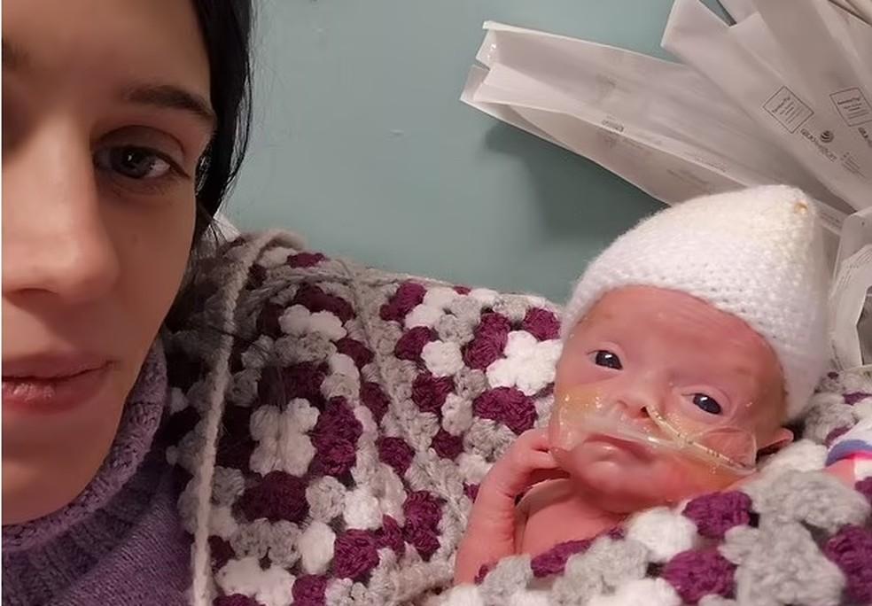 Oakley um bebe milagre e ainda se recupera no hospital Foto Reproduo Daily Mail
