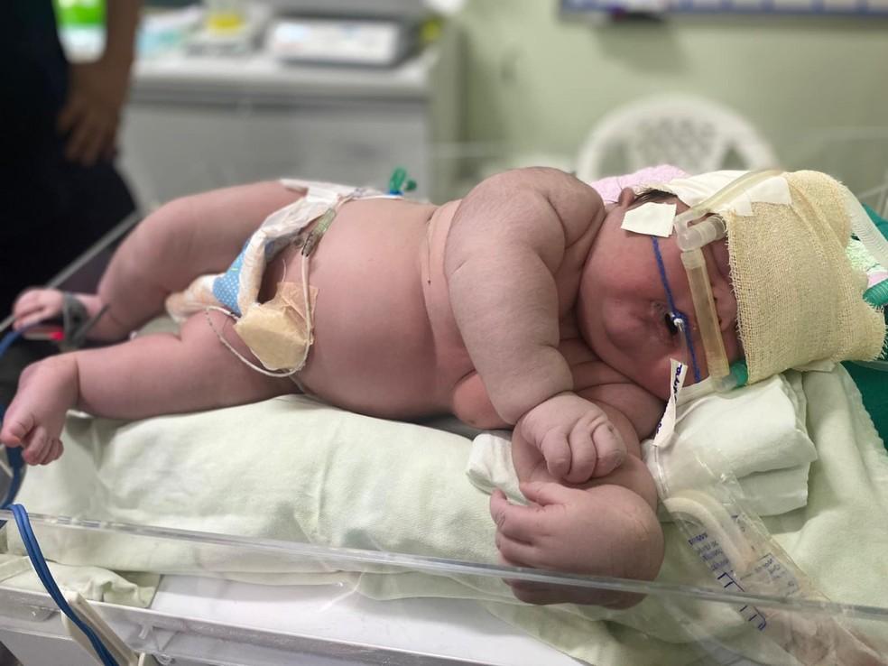 Image: https://fnmais.com/wp-content/uploads/2023/01/postiimg-63cad1049ff373779.jpeg Beb gigante Angerson Santos nasceu com mais de 7kg em Parintins no interior do AM Foto DivulgaoHospital Padre Colombo