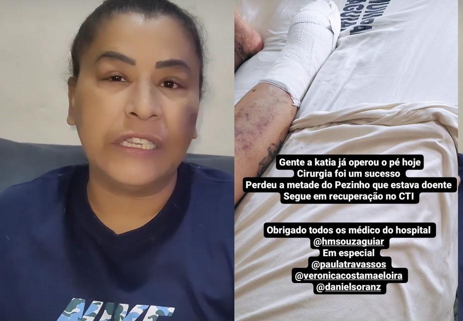 MC Ktia tem parte do p amputado