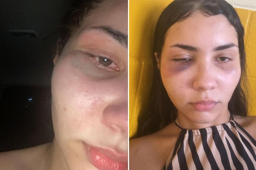 Laryssa afirmou ter sido agredida pela me aps question-la sobre uso de produto de limpeza no bairro Guilhermina em Praia Grande SP Foto Arquivo Pessoal